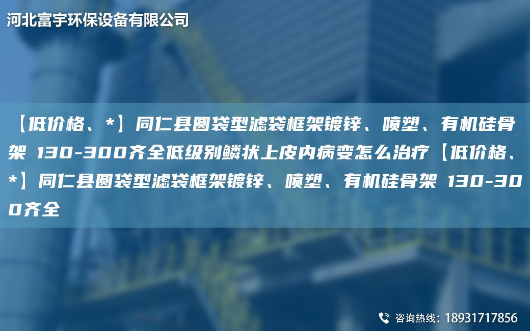 【低價格、*】同仁縣圓袋型濾袋框架鍍鋅、噴塑、有機硅骨架Φ130-300齊全低級別鱗狀上皮內(nèi)病變怎么治療【低價格、*】同仁縣圓袋型濾袋框架鍍鋅、噴塑、有機硅骨架Φ130-300齊全